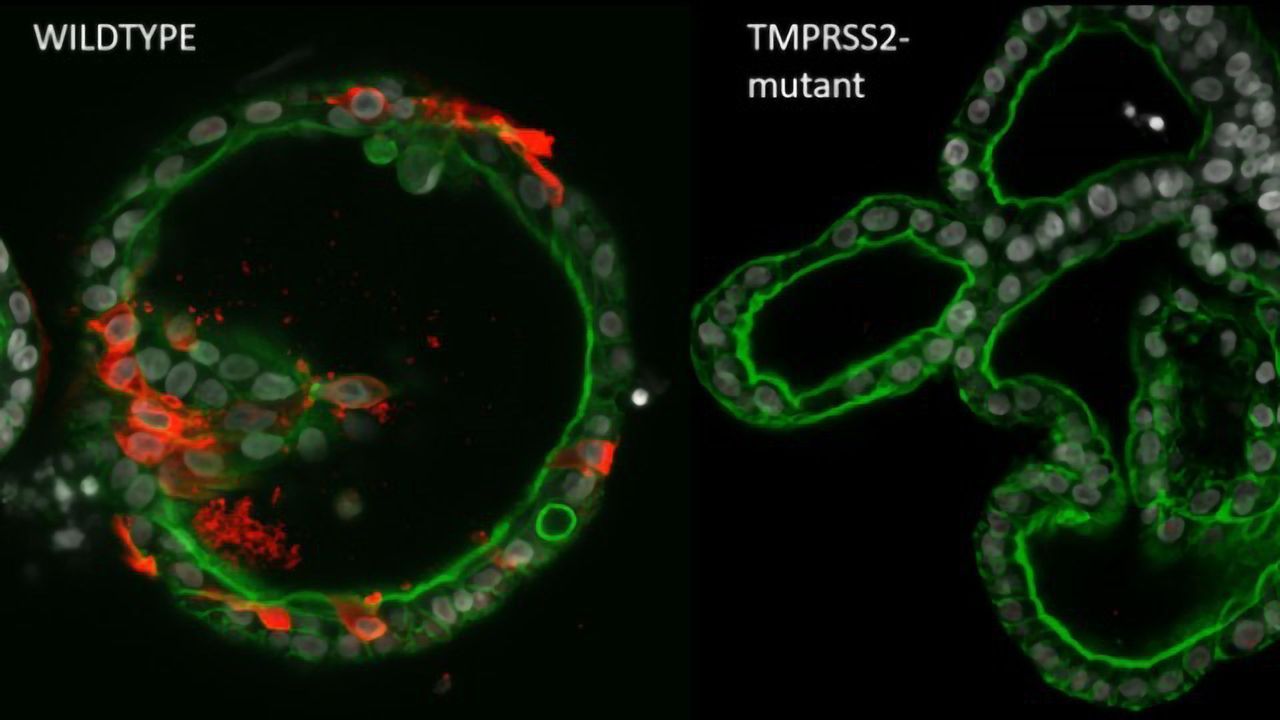 Organoid Biobank Established To Assess Potential Coronavirus Drug Targets