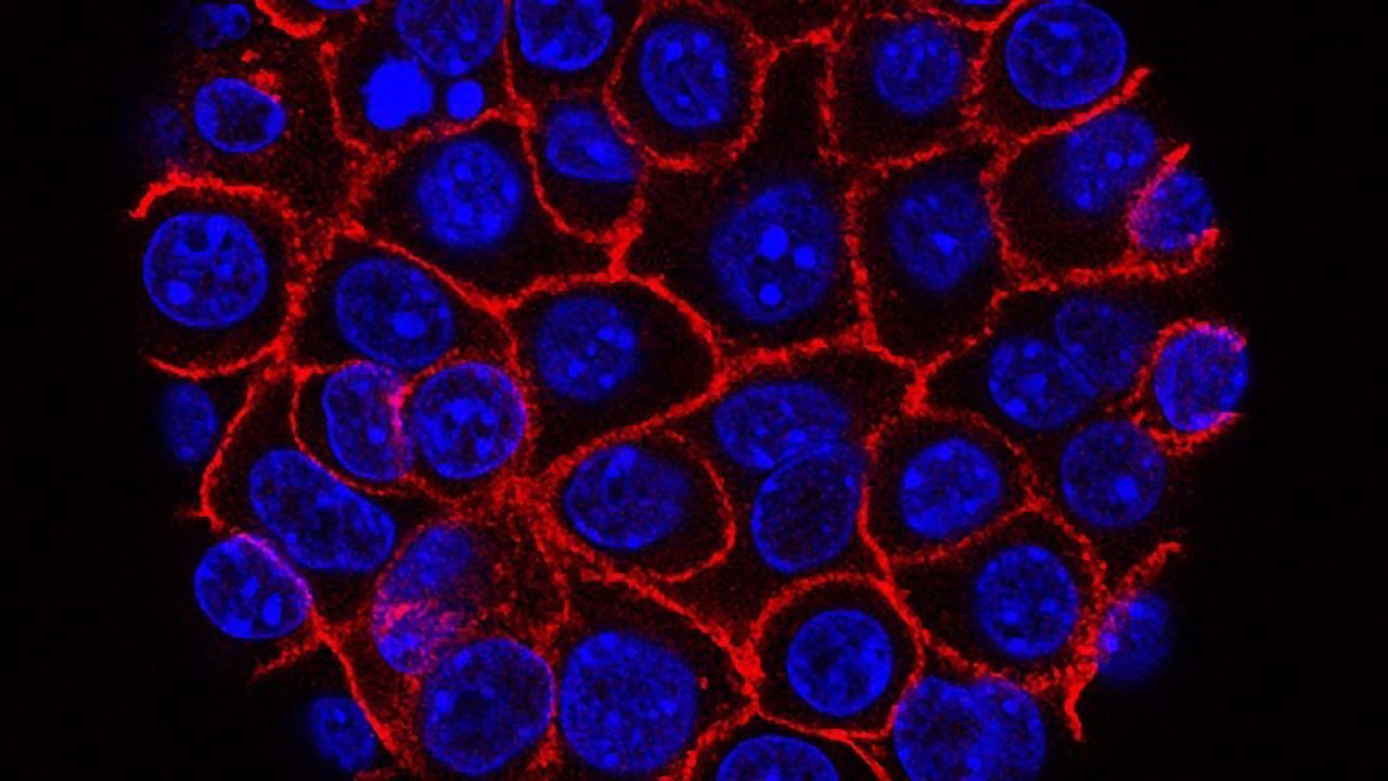 New Targets for Pancreatic Cancer Detection and Treatment Identified