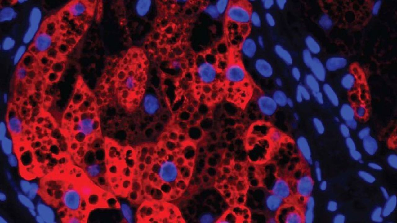 A Potential New Treatment Target for Eczema