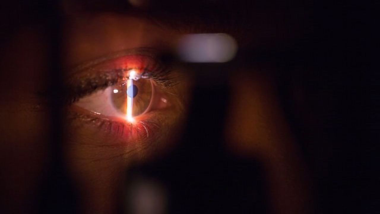 Diabetes Medications Linked to Glaucoma Prevention