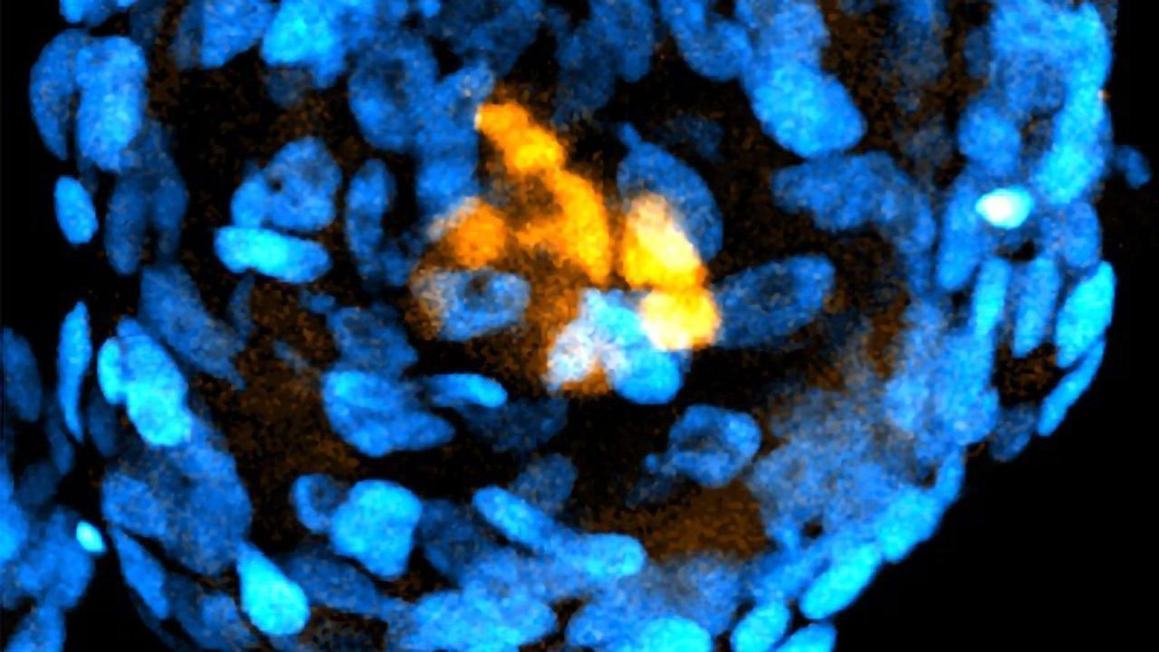 Embryo-Like Structures Created From Human Stem Cells