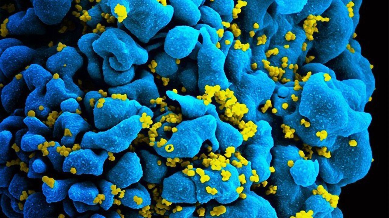 HIV-Infected T Cell