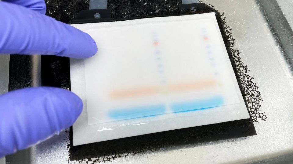A gloved hand places a western blot gel onto a membrane for protein analysis.