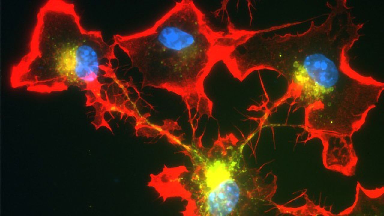 Immune Cells Form Network to Fight Parkinson's Protein