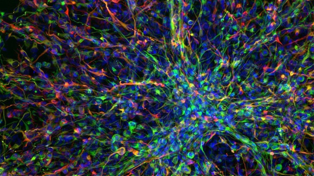 AI Identifies New Drug Combo for Aggressive Childhood Brain Cancer