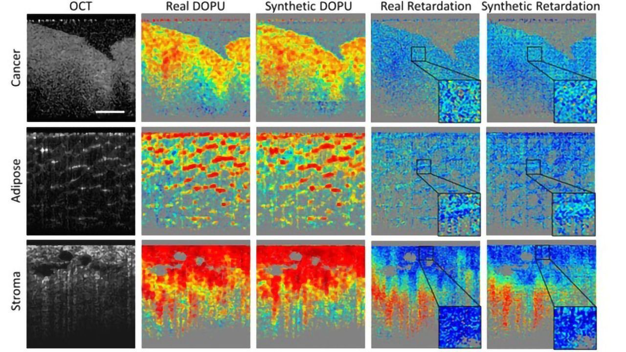 Deep Learning Enhances Cancer Diagnostic Tools