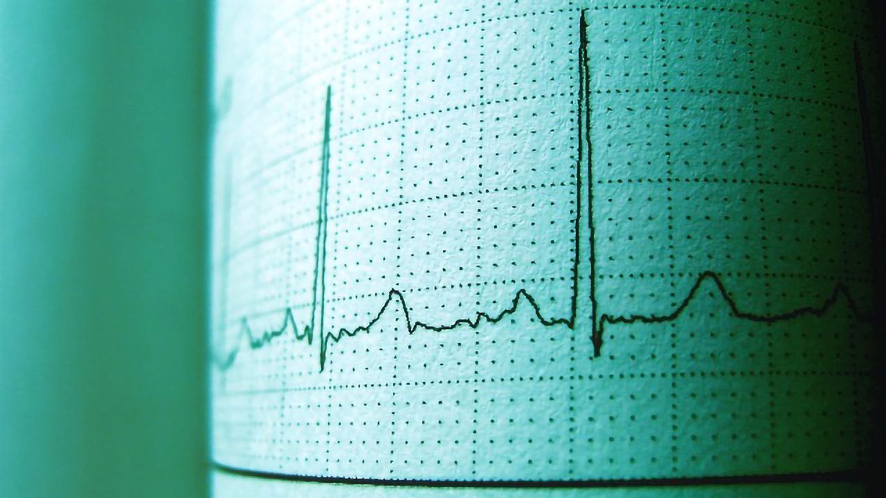 Radiation Therapy Reprograms Heart Muscle Cells to Younger State