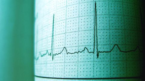 Radiation Therapy Reprograms Heart Muscle Cells to Younger State
