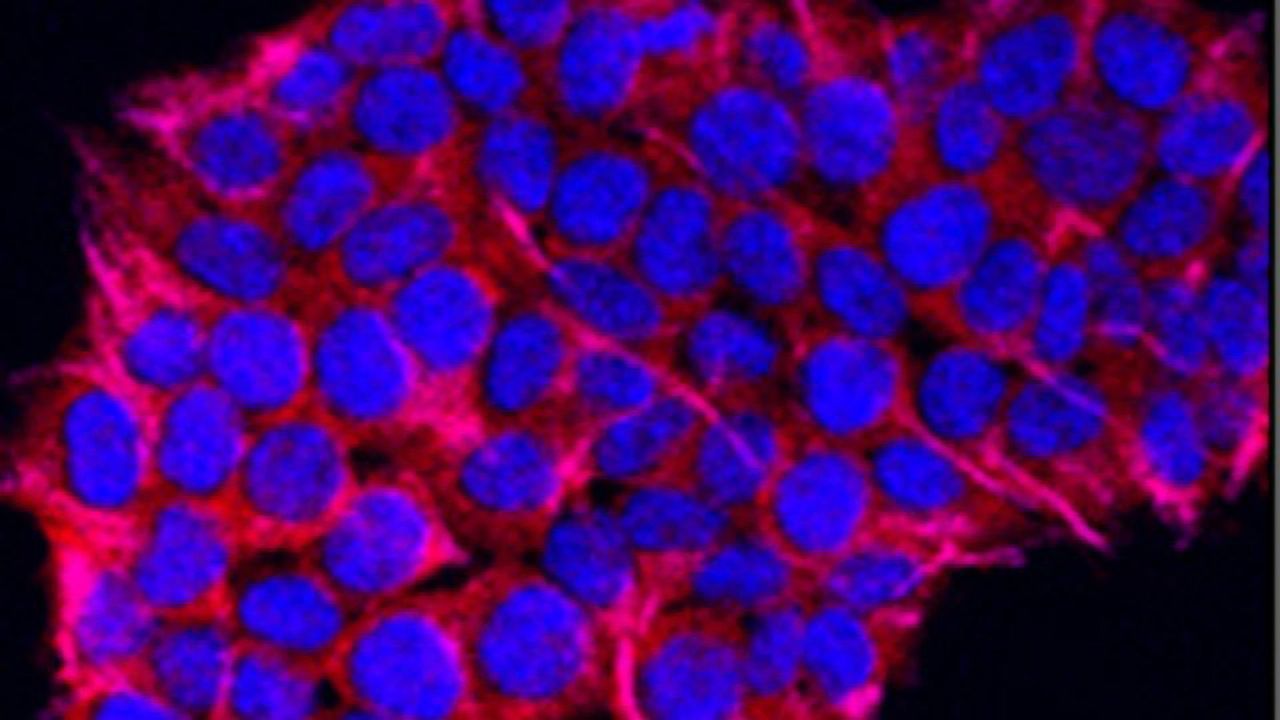 3D Tumor Models Could Improve Treatment for Pancreatic Cancer