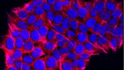 3D Tumor Models Could Improve Treatment for Pancreatic Cancer