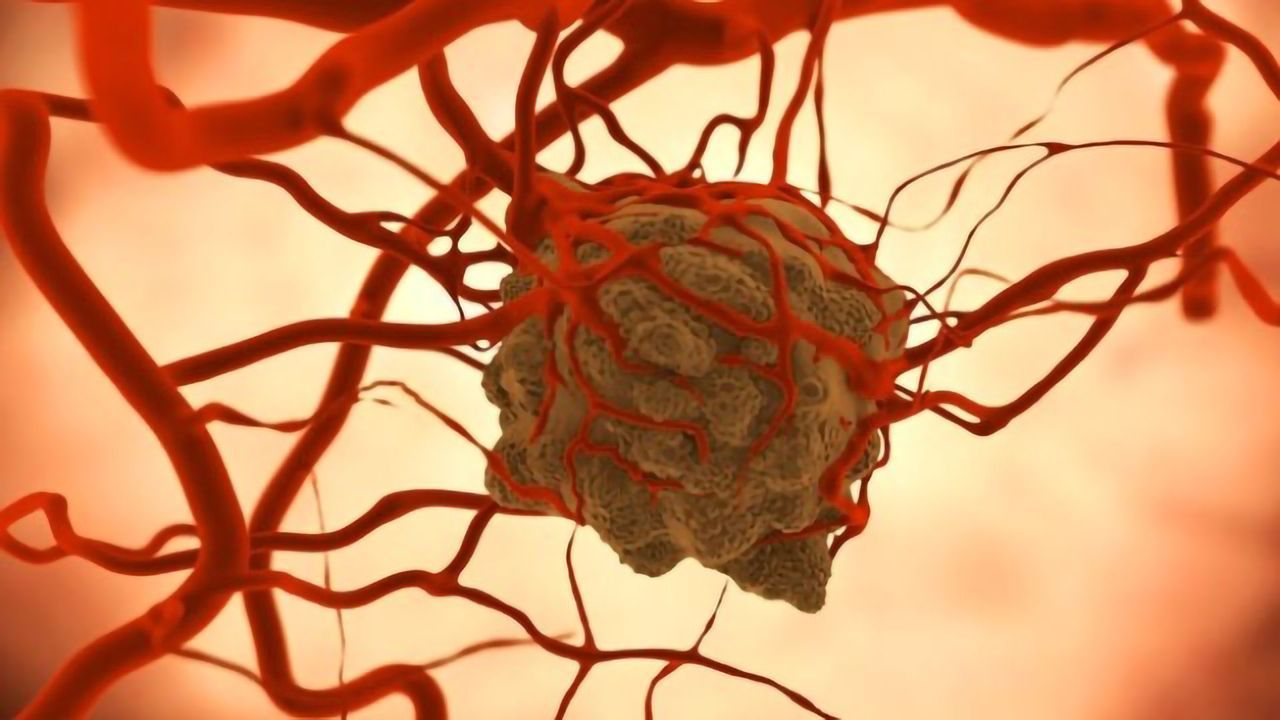 Grant Will Fuel Development of Lab-Grown Mini Tumors for Rare Cancers