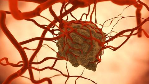 Grant Will Fuel Development of Lab-Grown Mini Tumors for Rare Cancers