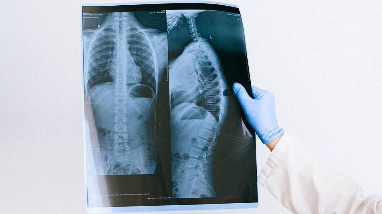 Old Radiology Reports Used by AI To Understand Medical Images