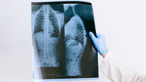 Old Radiology Reports Used by AI To Understand Medical Images