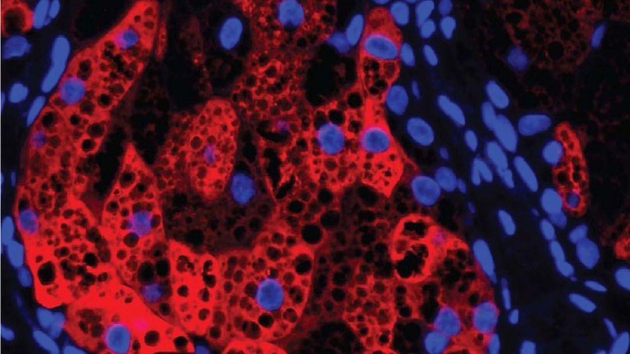 Human Sebaceous Gland