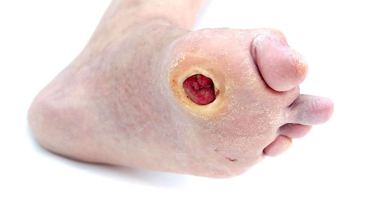 Simplifying Complex Wound Care With Innovative Medical Technologies
