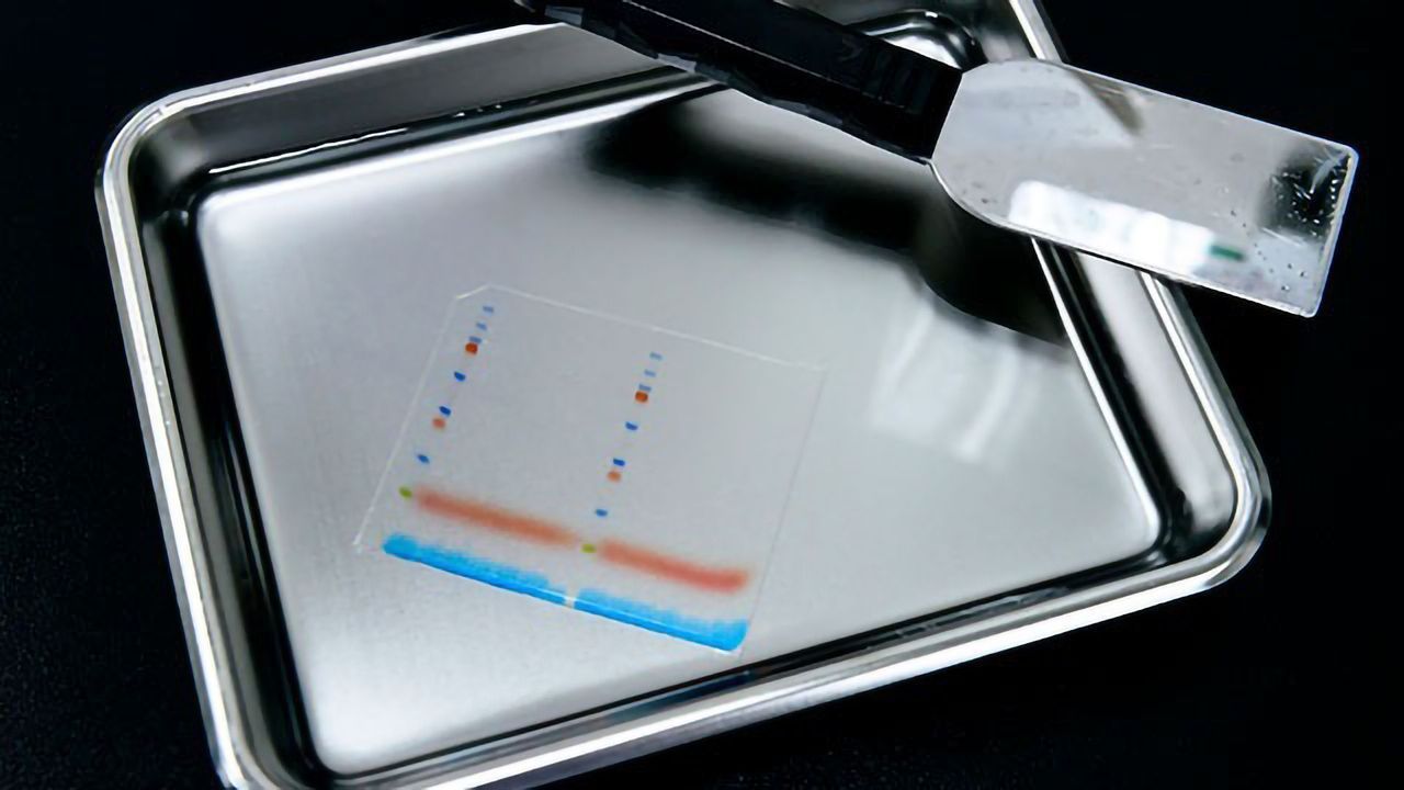How To Ensure a Successful Western Blot Experiment