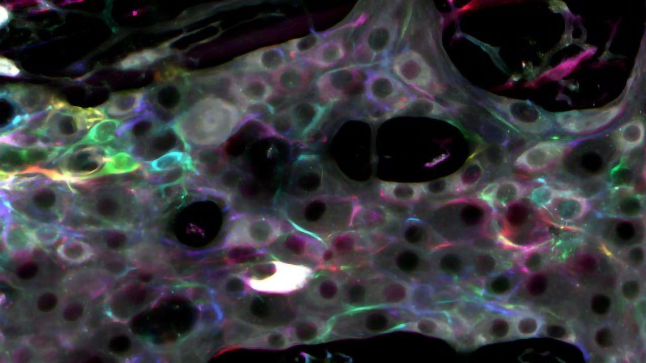 The Gut's "Second Brain" Network Revealed in New Mapping Study