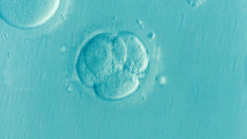 Earliest Effects of Huntington’s Identified in Two-Week-Old Embryo content piece image