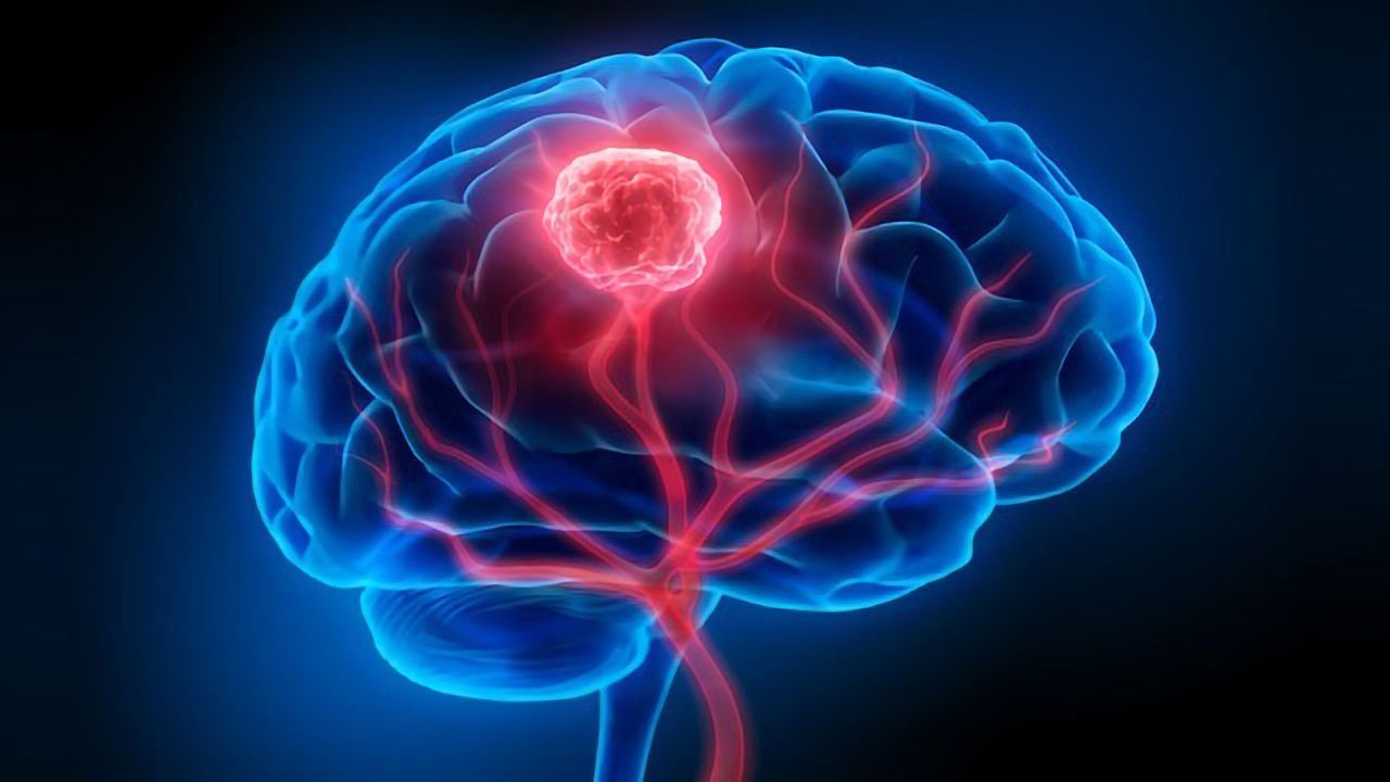 Early Detection of Brain Tumors and Beyond