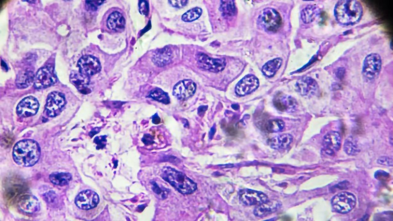 3D Co-Culture Spheroids With Human Liver Cells