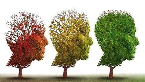Investigational Alzheimer’s Drug CMS121 Begins Phase I Clinical Testing