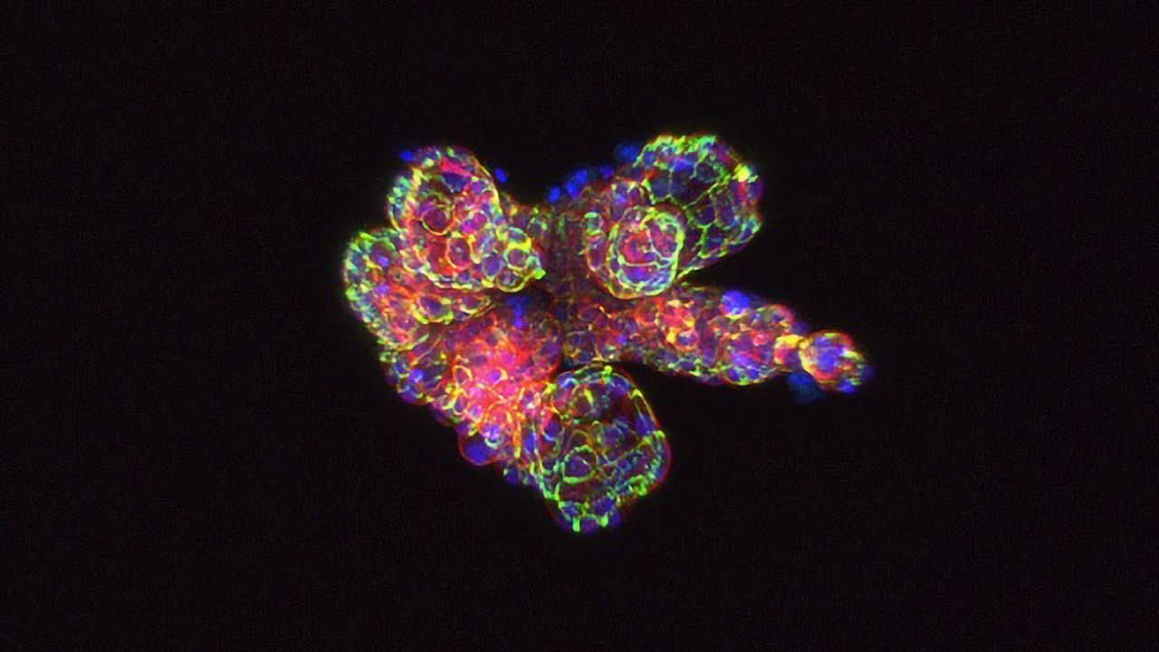 Looking Deeper: Imaging and Analysis of Advanced 3D Cellular Models