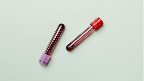 Blood Levels of Certain microRNAs Indicate Risk for Cognitive Decline