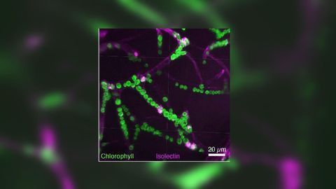 Green Algae "Lung" Can Provide Oxygen to the Brain