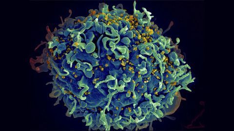 Metabolic Restoration for HIV-Infected Patients a Potential Therapeutic Approach