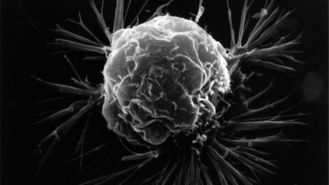 BRCA2 Requires a Specific Enzyme To Repair DNA Damage