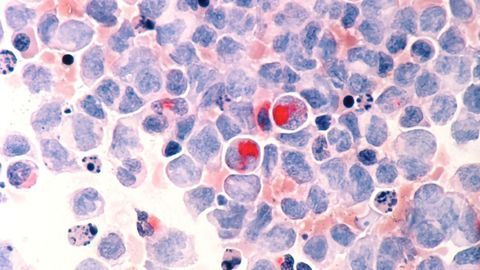 New Technology Finds Hidden Cancer Cells