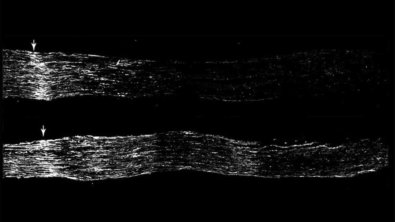 Cholesterol Drug Heals Sensory Neurons in Mice
