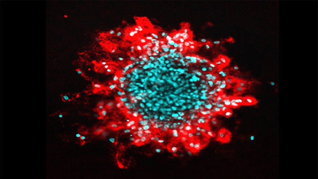Human Tumour Cells Invading a Collagen Matrix