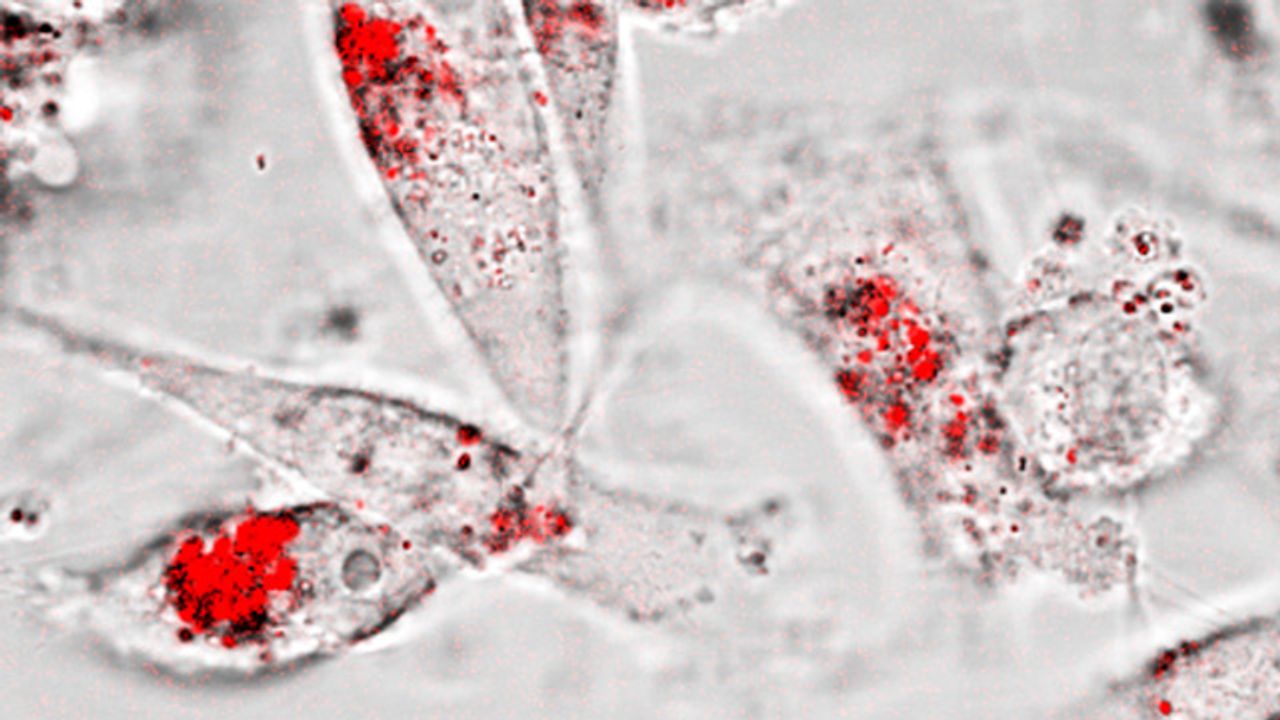 Nanoparticles Created To Communicate With Cancer Cells
