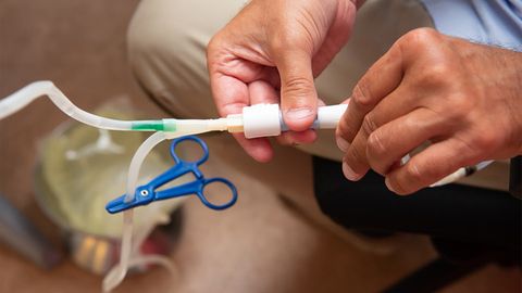 A Step Towards Precision Dialysis Treatment