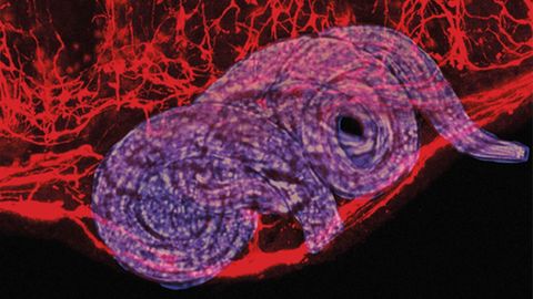 Glial Cells Crucial to Maintaining Healthy Gut Immunity