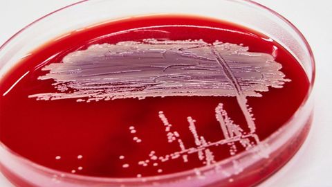 Ingenious Method Used by Staphylococcus To Protect Itself From Antibiotics