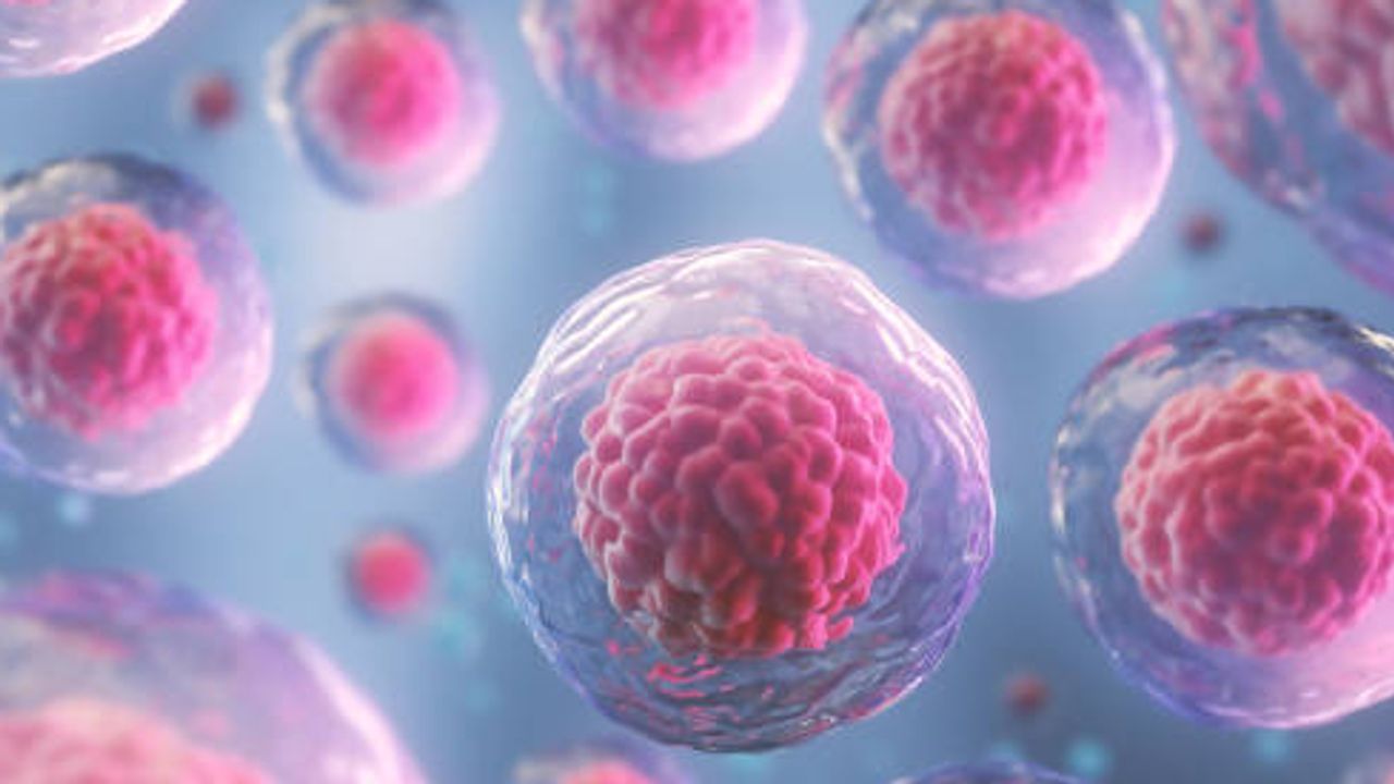 Identification of a Tumor–Specific Gene Regulatory Network in Human B-Cell Lymphoma