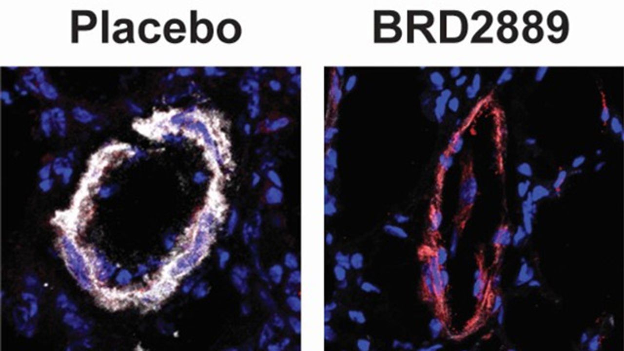 Repurposing Cancer Drugs To Treat Rare Diseases