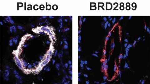 Repurposing Cancer Drugs To Treat Rare Diseases