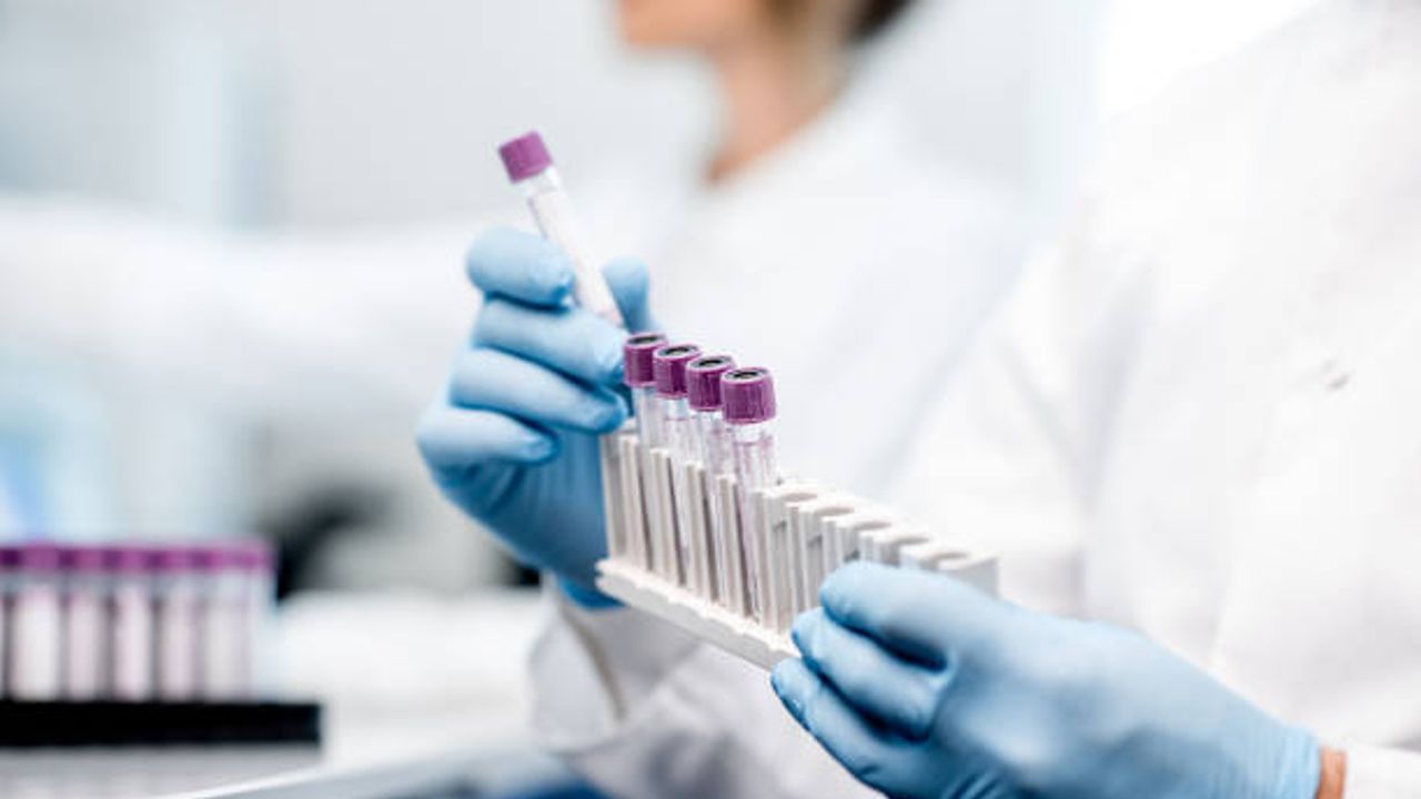 Mannose Glycans Content Screening for Human-mAb Samples