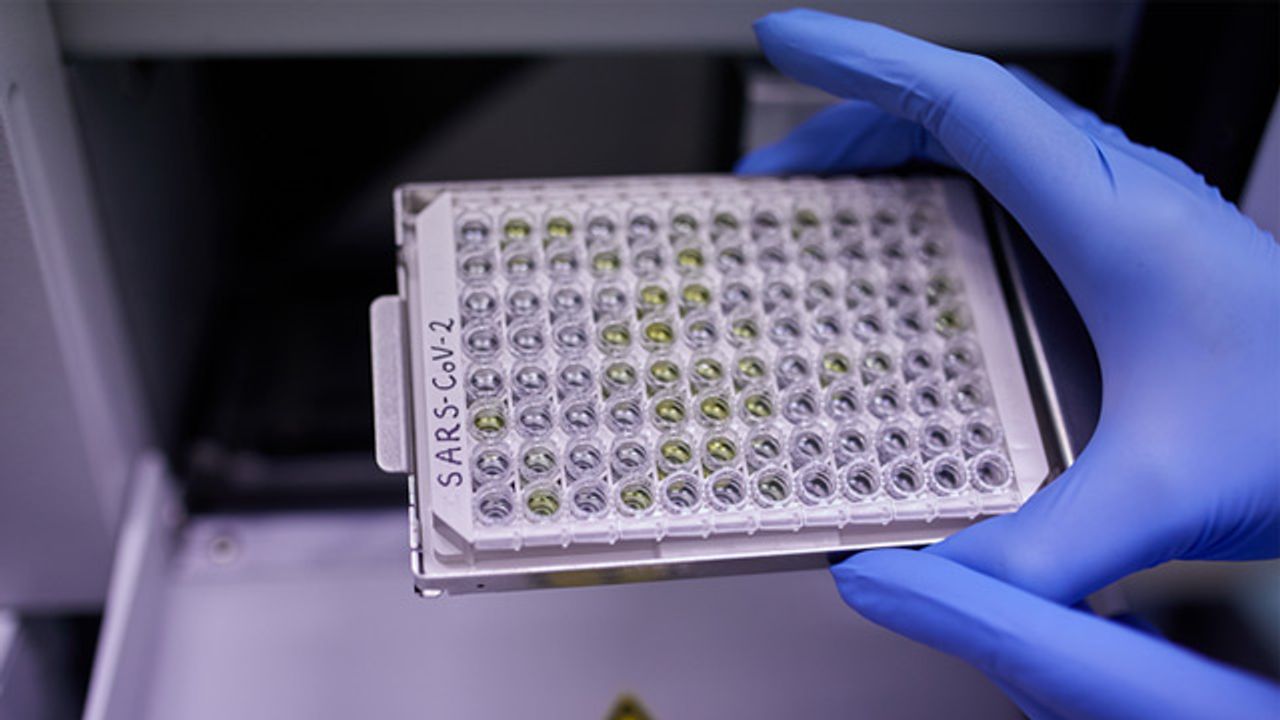 Immune Response Timings Disrupted by SARS-CoV-2