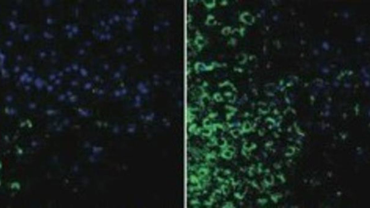 Air Pollution Reduces Sperm Count Through Brain Inflammation