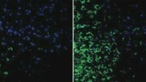 Air Pollution Reduces Sperm Count Through Brain Inflammation