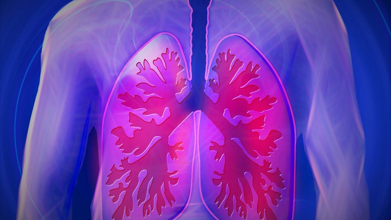 A New Artificial Intelligence Model for a More Accurate Lung Cancer Diagnosis