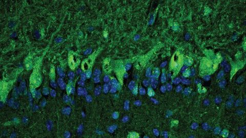 Why Did Three Teenagers Develop Psychiatric Symptoms After COVID-19?