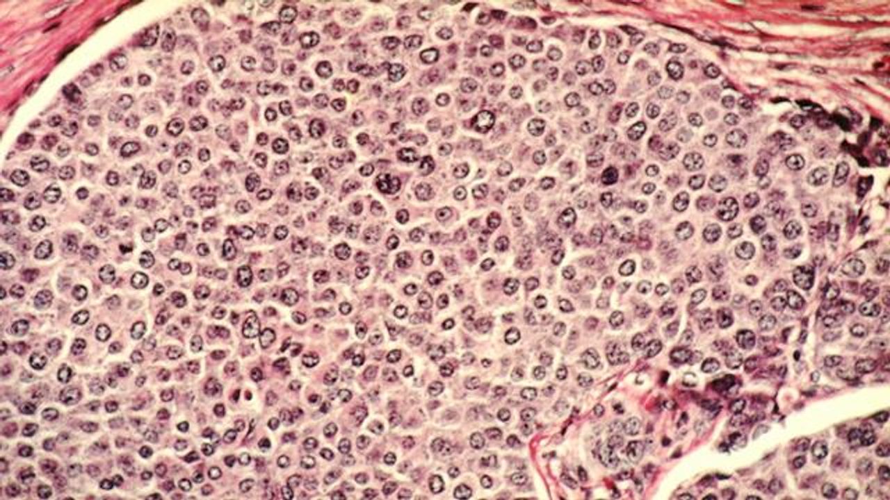 Why Cancers Thrive in Chromosomal Chaos