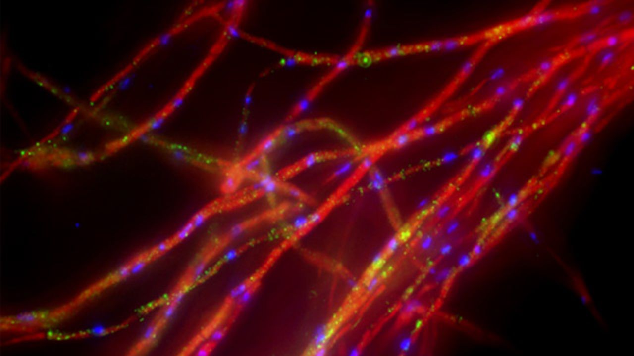 Fungal Hyphae