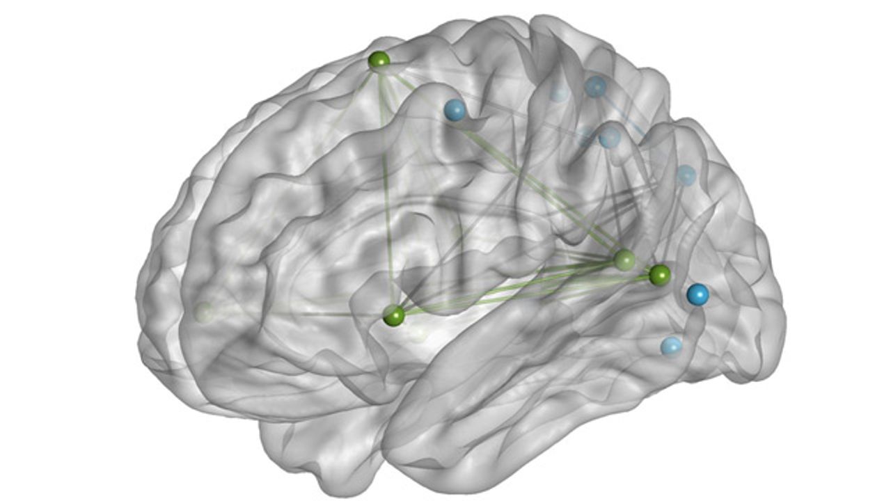 Adults With PTSD Have Lower Brain Connectivity